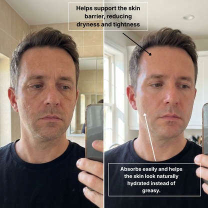 Beef Tallow Honey Balm